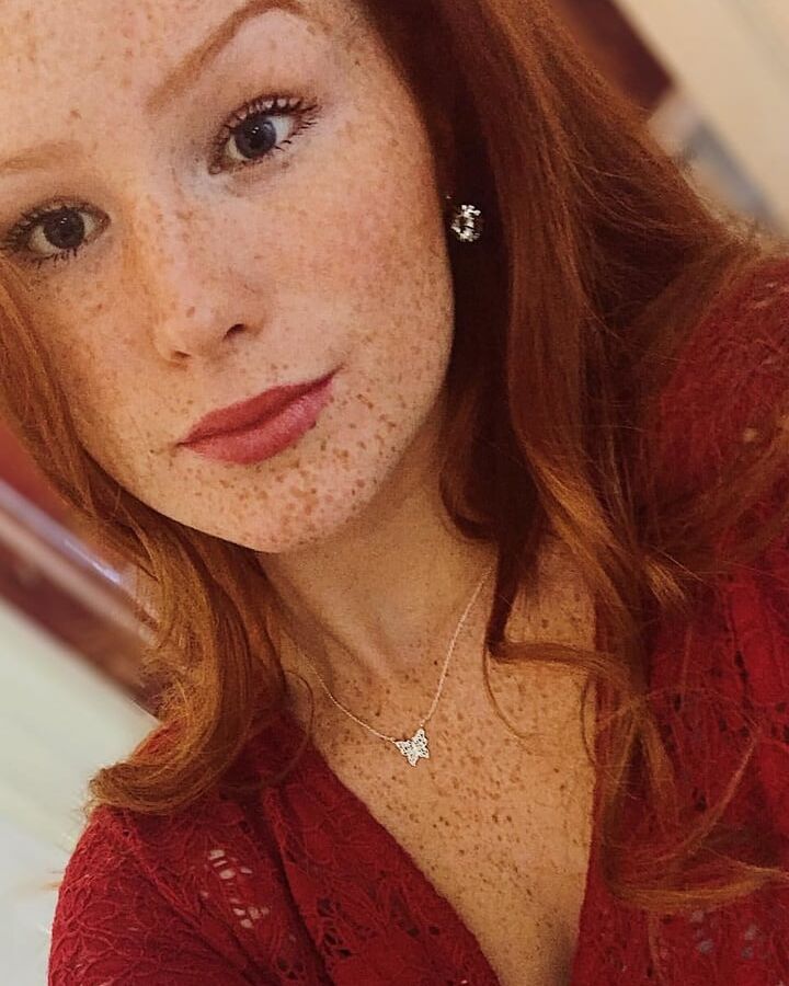 Freckled Beauty Victoria