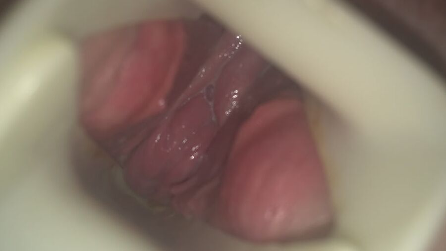 Gemma