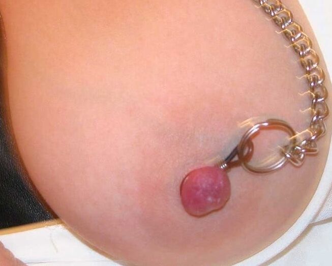 nipple pain