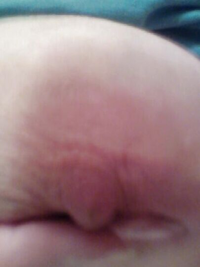 Old Nipples