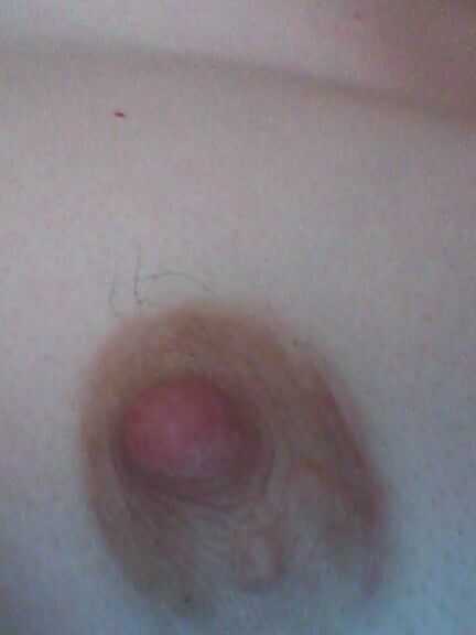 Chirurgy cyst