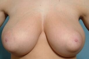 libido_itch