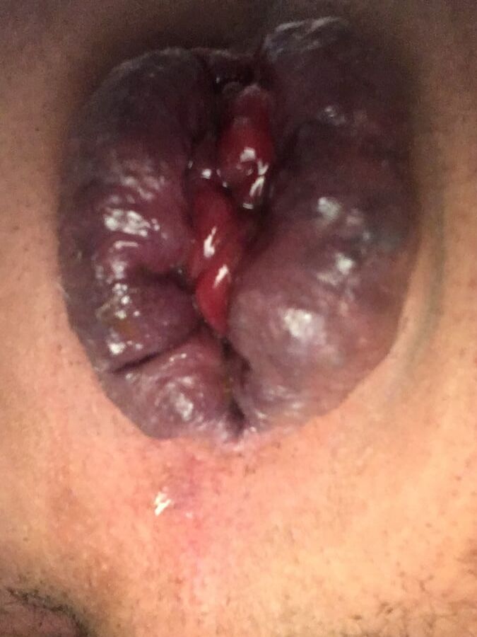Tampon
