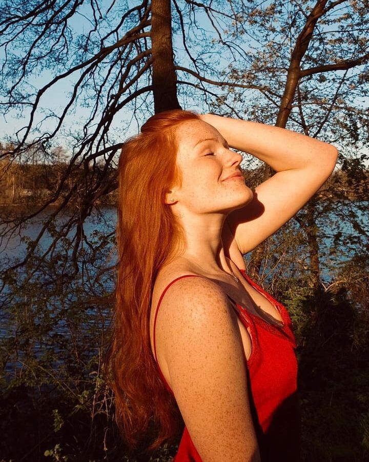 Freckled Beauty Victoria