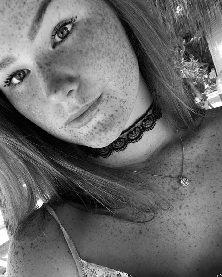 Freckled Beauty Victoria