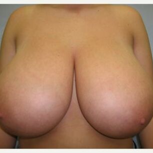 libido_itch
