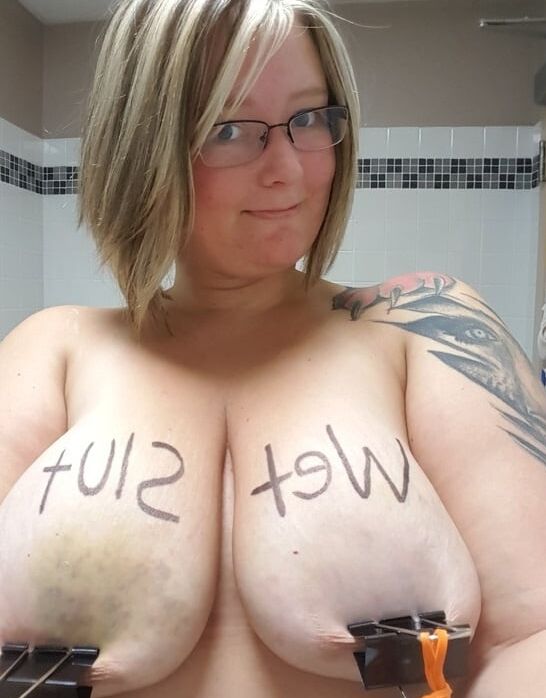 Breast pain