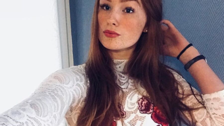 Freckled Beauty Victoria