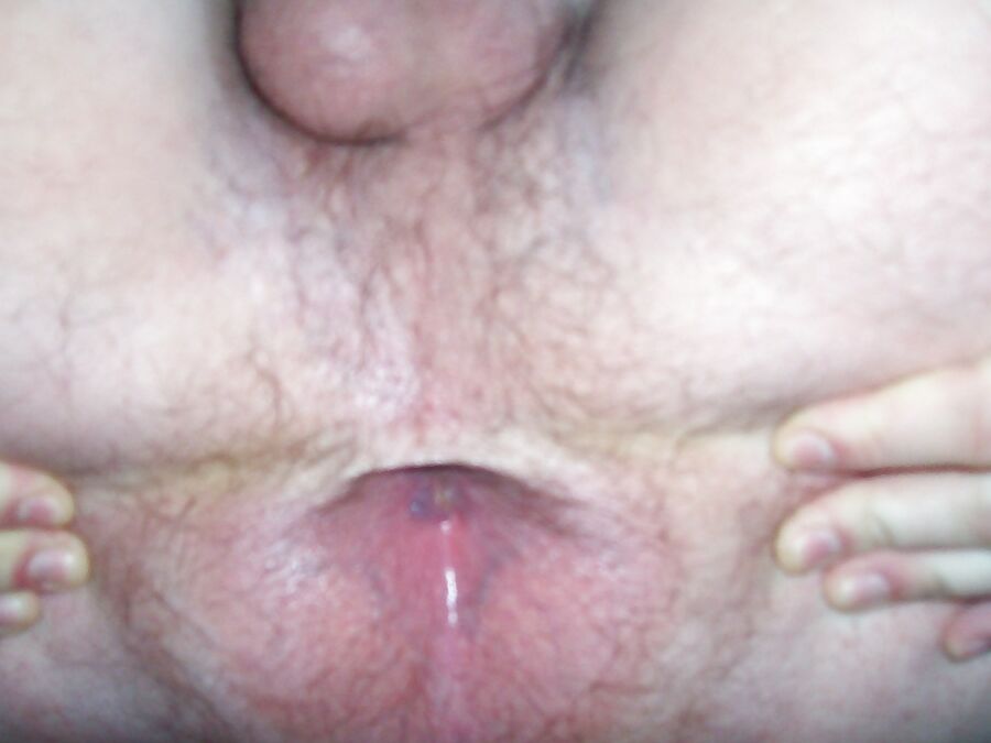 Rixiluv&;s hairy asshole