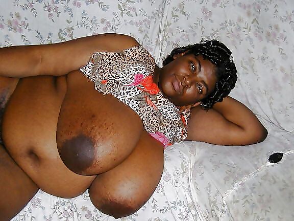 Lovely BBW Model With Acne Tits