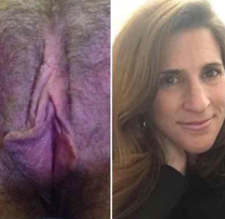 Before and after