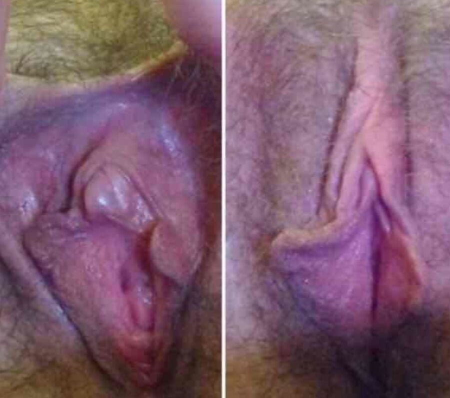 Before and after
