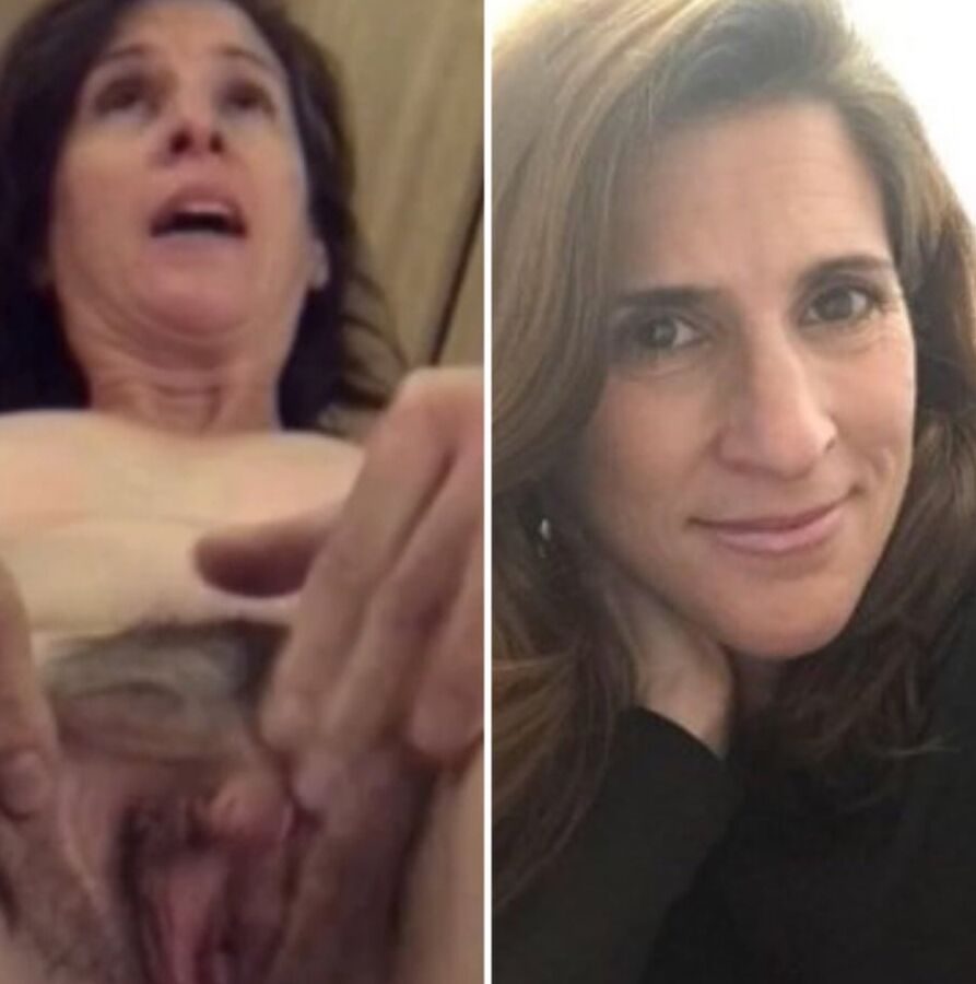 Before and after