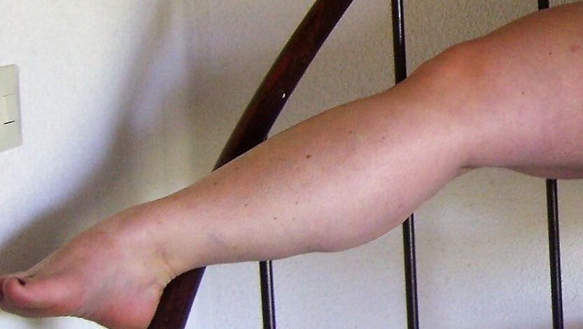 Sexy &amp; Chubby Legs