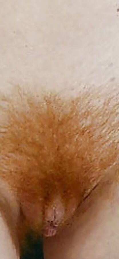 Hairy