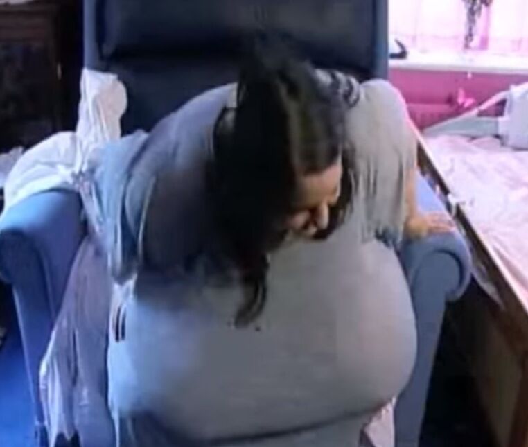 Biggest Monster macromastia