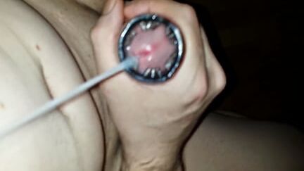 Sperma