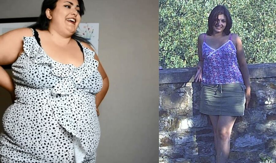Weight Gain Before And After