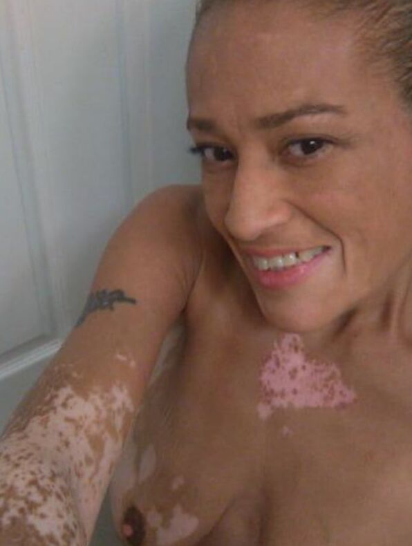 Local Whore - With Vitiligo - Best Pussy