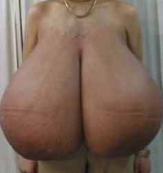 Biggest Monster macromastia