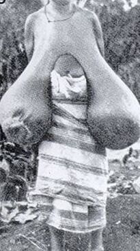 Biggest Monster macromastia