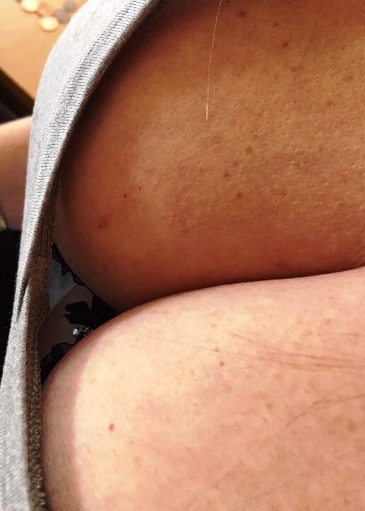 Angles and Spangles