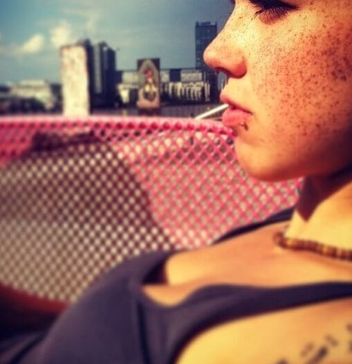 Freckles