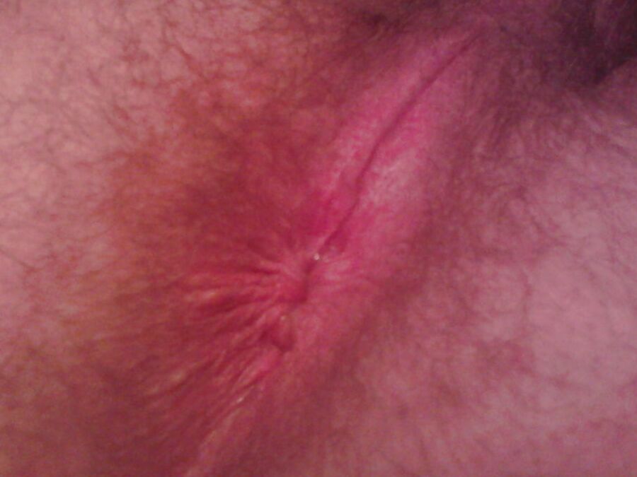 My ass hole