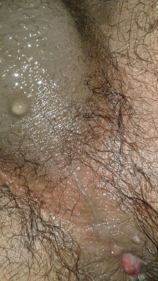 My ass hole