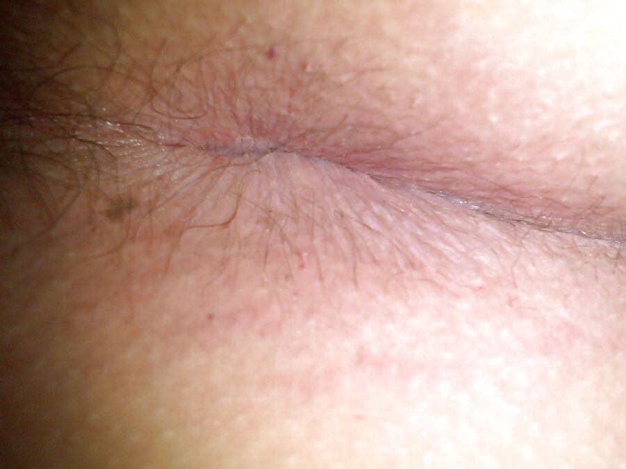 My ass hole