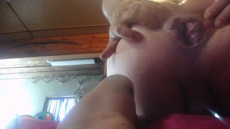 gape