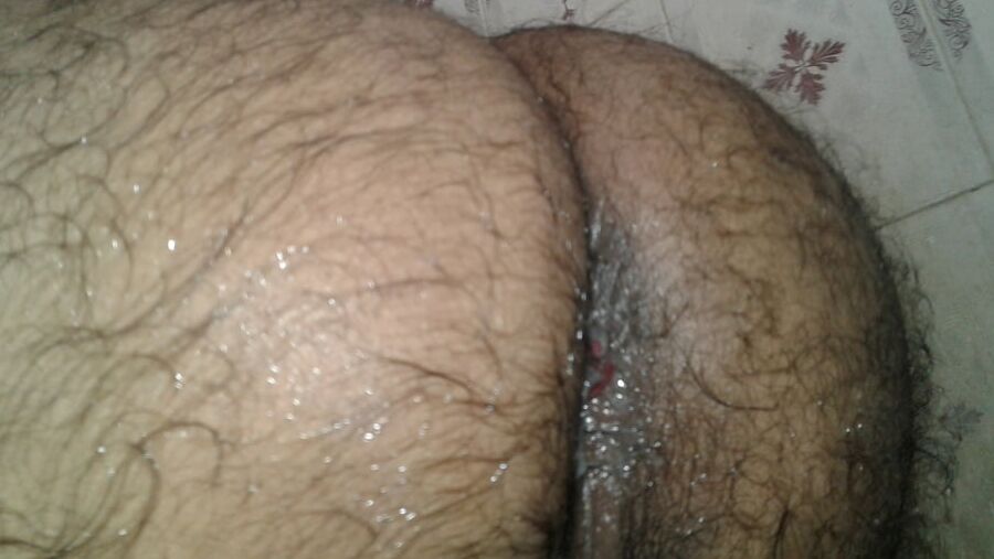 My ass hole