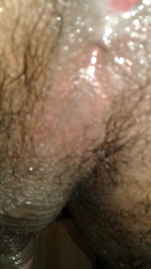 My ass hole