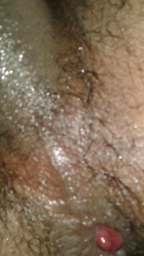 My ass hole