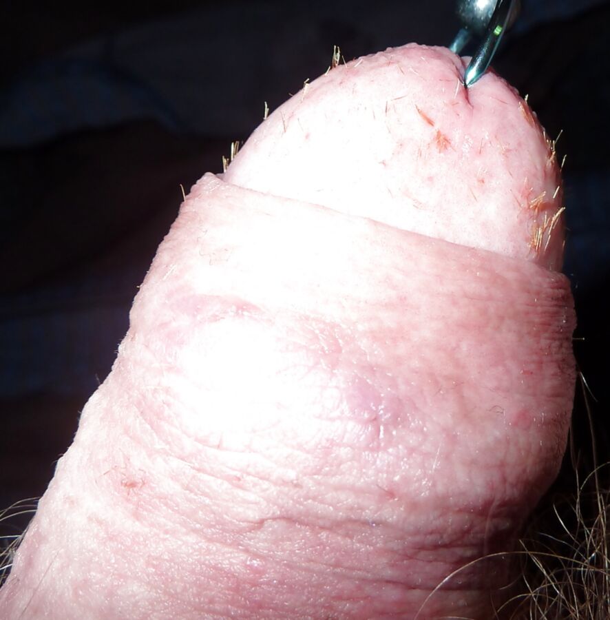 百