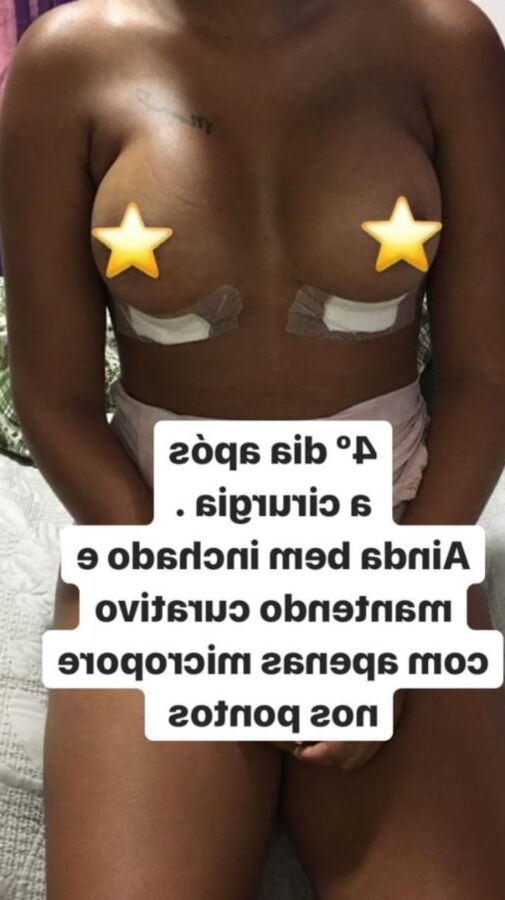 Mulata siliconada
