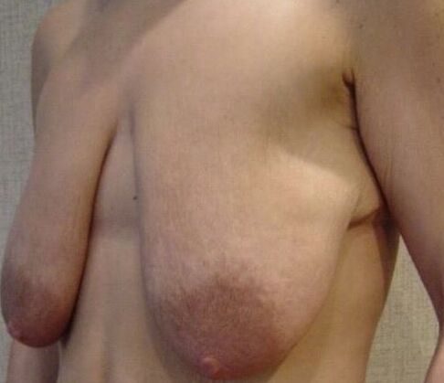 saggy