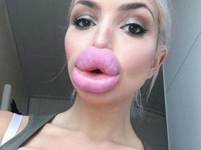 Lovley Lips