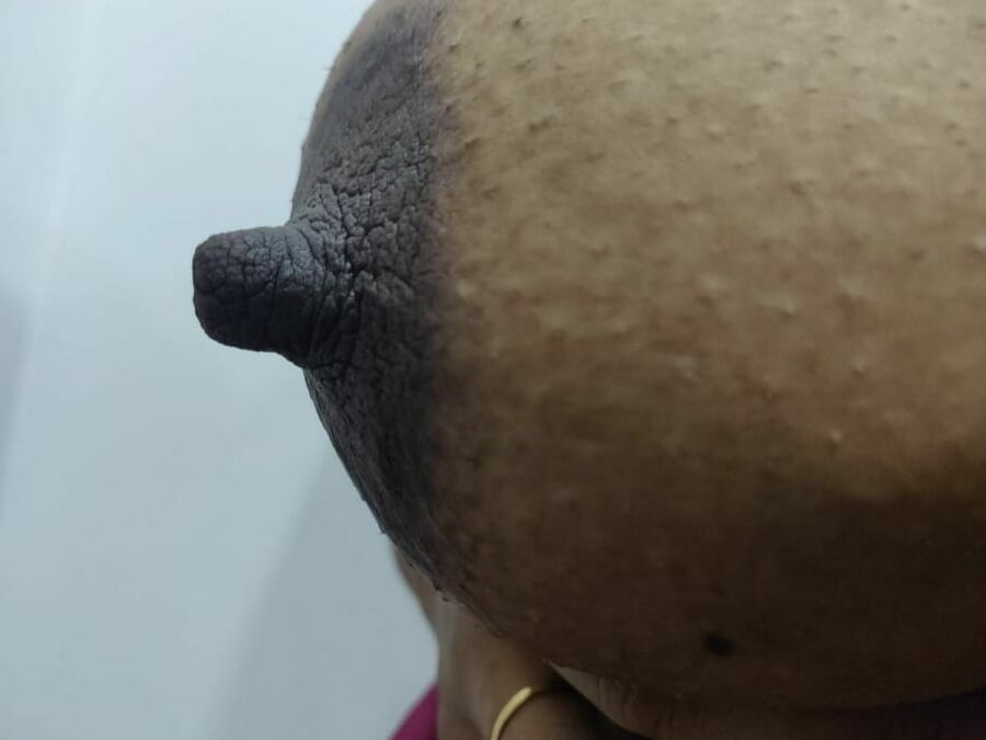IN