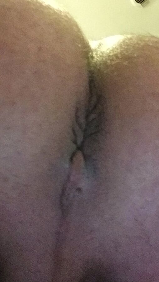 Mi BI bottom side