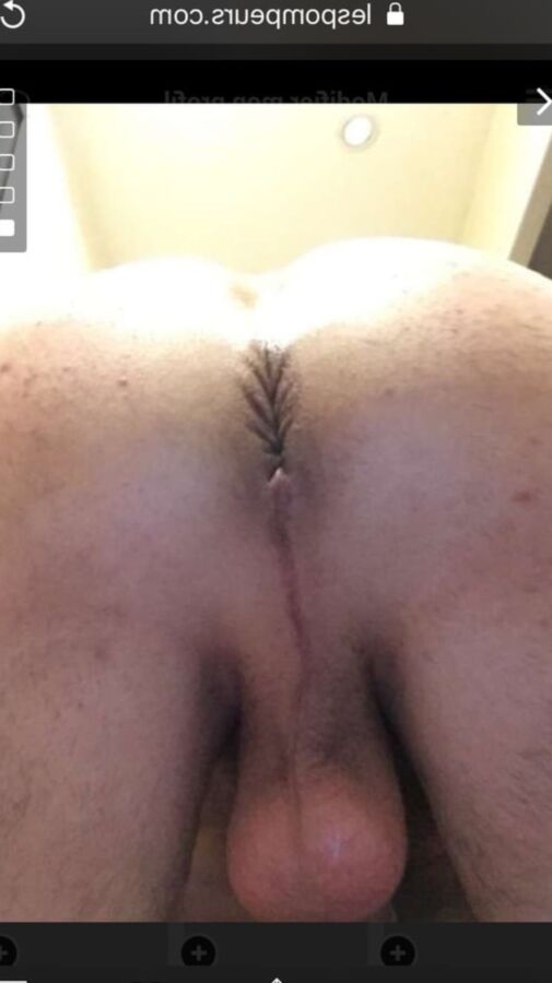 Mi BI bottom side