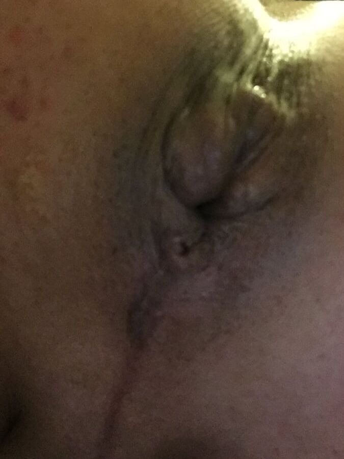Mi BI bottom side