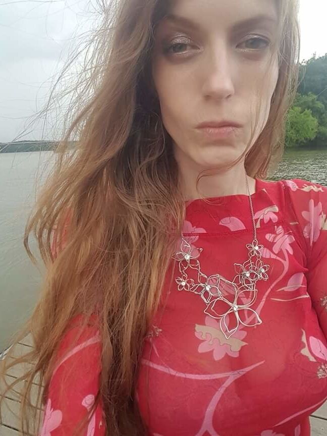 Post Transition pictures of me.