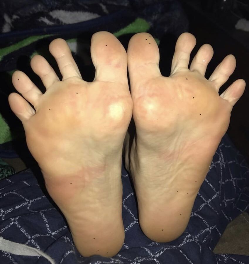 beckywiththegoodfeet
