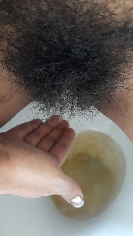 Smegma sebo, sebinho