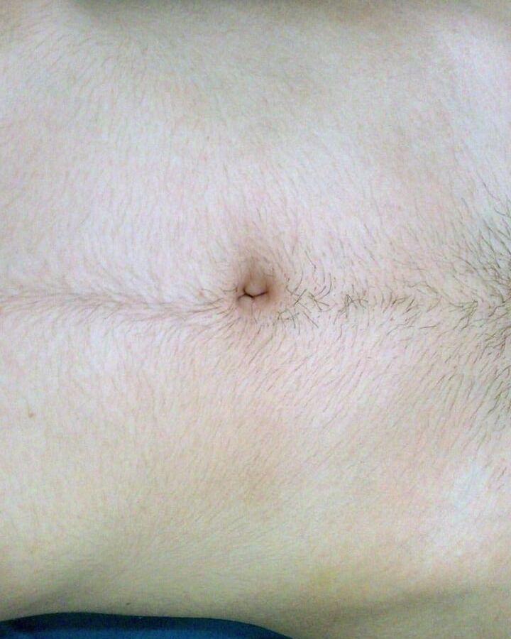 hairy cleavage collection