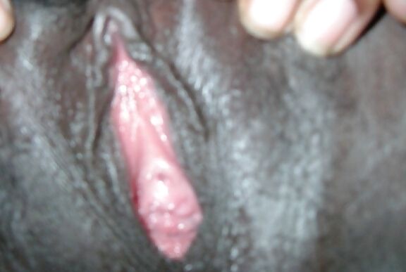 Freak Hoe