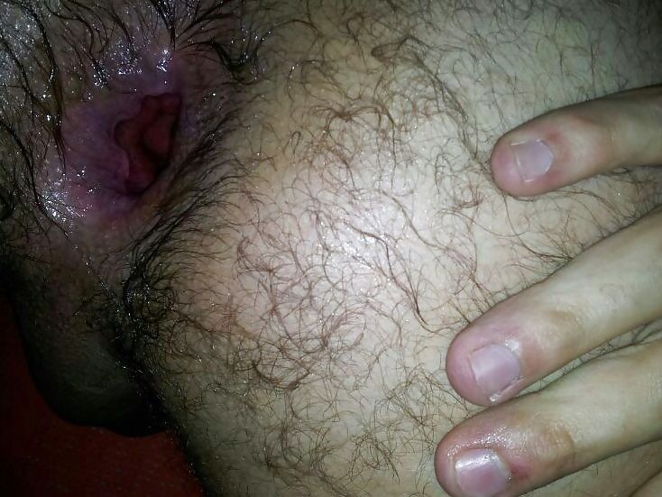 My holez after anal