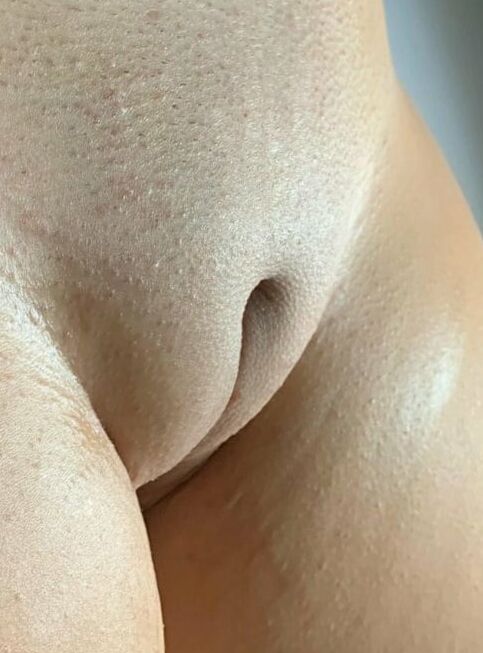 Yesss