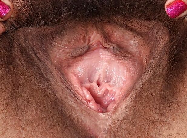 Hairy Anne